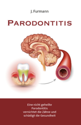 Parodontitis - J. Furmann