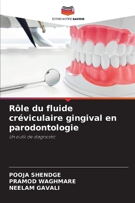 Rôle du fluide créviculaire gingival en parodontologie - POOJA Shendge, Pramod Waghmare, Neelam Gavali