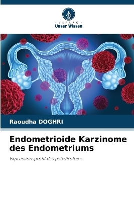 Endometrioide Karzinome des Endometriums - Raoudha DOGHRI