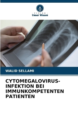 Cytomegalovirus-Infektion Bei Immunkompetenten Patienten - WALID Sellami