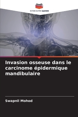 Invasion osseuse dans le carcinome épidermique mandibulaire - Swapnil Mohod