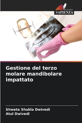 Gestione del terzo molare mandibolare impattato - Shweta Shukla Dwivedi, Atul Dwivedi