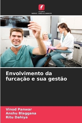 Envolvimento da furcação e sua gestão - Vinod Panwar, Anshu Blaggana, Ritu Dahiya