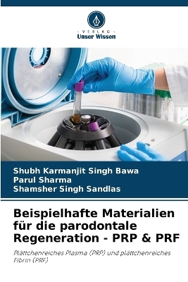 Beispielhafte Materialien für die parodontale Regeneration - PRP & PRF - Shubh Karmanjit Singh Bawa, Parul Sharma, Shamsher Singh Sandlas