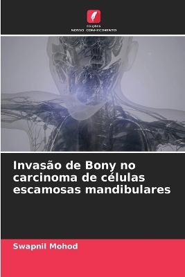 Invasão de Bony no carcinoma de células escamosas mandibulares - Swapnil Mohod