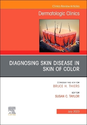 Diagnosing Skin Disease in Skin of Color, An Issue of Dermatologic Clinics - 