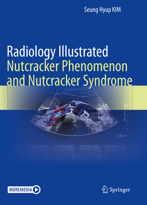 Radiology Illustrated: Nutcracker Phenomenon and Nutcracker Syndrome - Seung HYup Kim