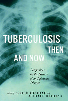 Tuberculosis Then and Now -  Flurin Condrau,  Michael Worboys