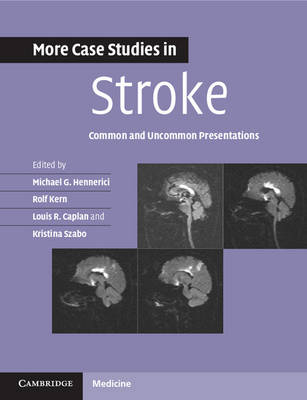 More Case Studies in Stroke - 