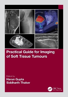 Practical Guide for Imaging of Soft Tissue Tumours - 