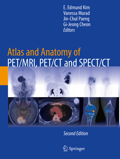 Atlas and Anatomy of PET/MRI, PET/CT and SPECT/CT - 