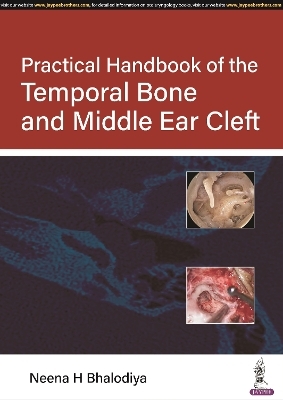 Practical Handbook of the Temporal Bone and Middle Ear Cleft - Neena H Bhalodiya