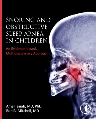 Snoring and Obstructive Sleep Apnea in Children - 