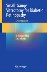 Small-Gauge Vitrectomy for Diabetic Retinopathy - Spandau, Ulrich; Tomic, Zoran