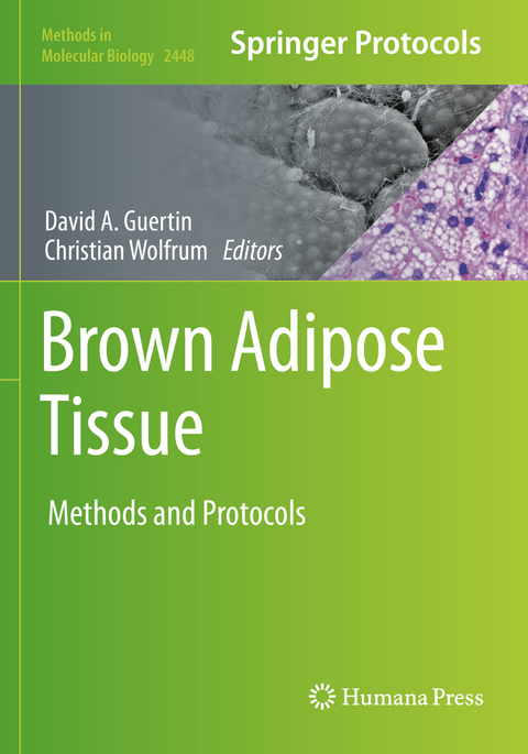 Brown Adipose Tissue - 