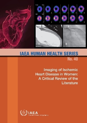 Imaging of Ischemic Heart Disease in Women -  Iaea