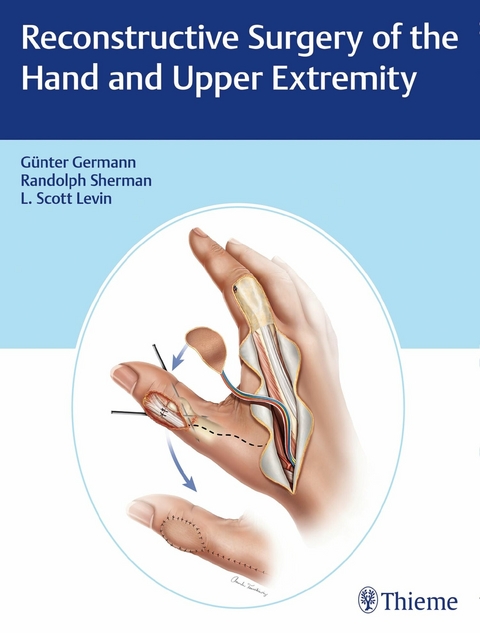 Reconstructive Surgery of the Hand and Upper Extremity -  Günter Germann,  L. Scott Levin,  Randolph Sherman