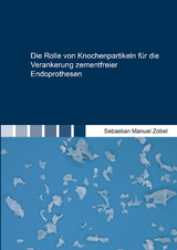 Die Rolle von Knochenpartikeln für die Verankerung zementfreier Endoprothesen - Sebastian Manuel Zobel