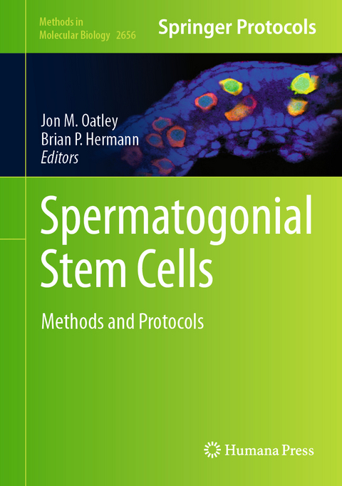 Spermatogonial Stem Cells - 