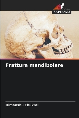 Frattura mandibolare - Himanshu Thukral