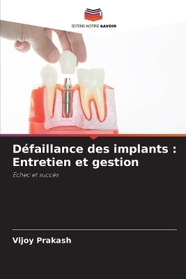 Défaillance des implants - Vijoy Prakash