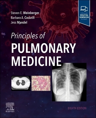 Principles of Pulmonary Medicine - Steven E. Weinberger, Barbara A. Cockrill, Jess Mandel