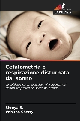 Cefalometria e respirazione disturbata dal sonno - Shreya S, Vabitha Shetty