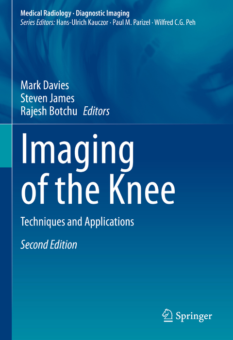 Imaging of the Knee - 