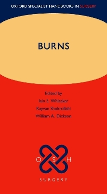 Burns - 