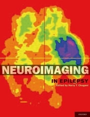 Neuroimaging in Epilepsy - 