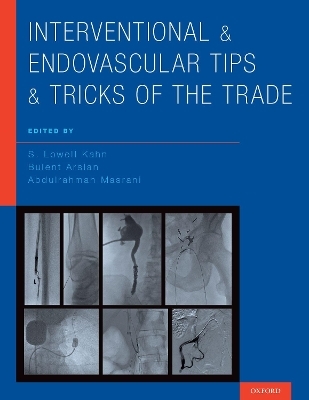 Interventional and Endovascular Tips and Tricks of the Trade - 