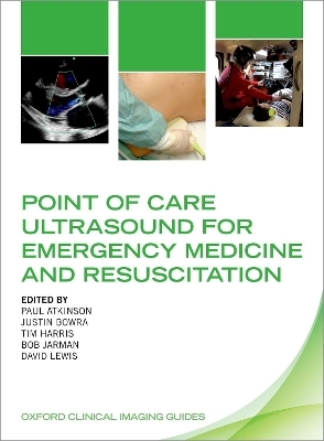 Point of Care Ultrasound for Emergency Medicine and Resuscitation - 