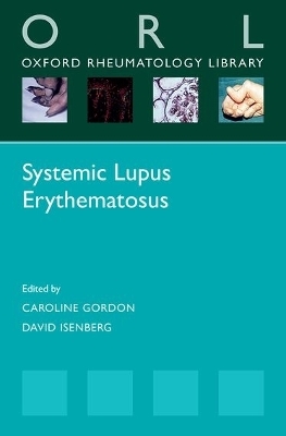 Systemic Lupus Erythematosus - 