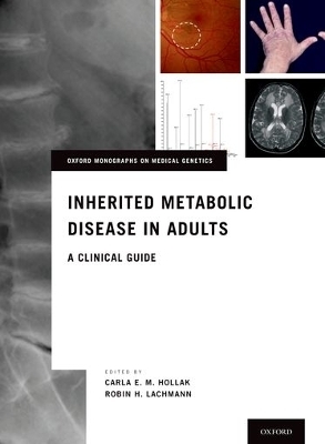 Inherited Metabolic Disease in Adults - 