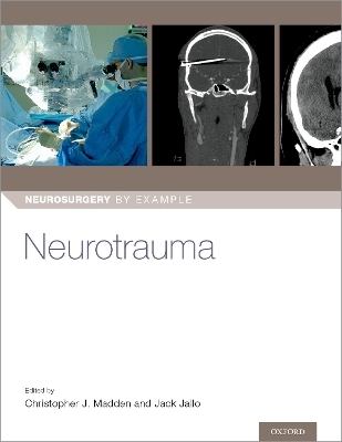 Neurotrauma - 