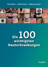 Die 100 wichtigsten Hauterkrankungen - Harald Kittler, Elisabeth Riedl, Wolfgang P. Weninger