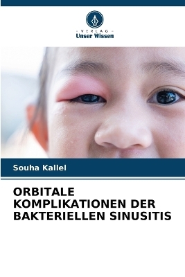 Orbitale Komplikationen Der Bakteriellen Sinusitis - Souha Kallel