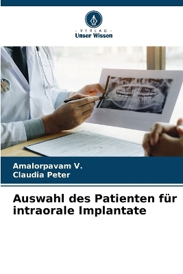 Auswahl des Patienten für intraorale Implantate - Amalorpavam V, Claudia Peter