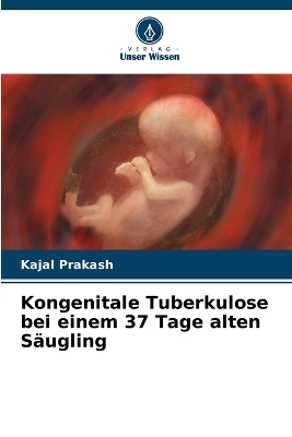 Kongenitale Tuberkulose bei einem 37 Tage alten Säugling - Kajal Prakash