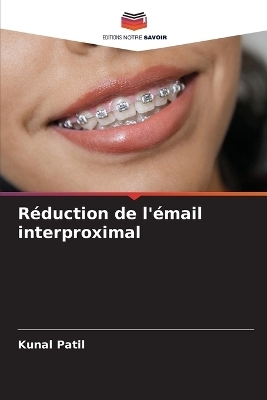 Réduction de l'émail interproximal - Kunal Patil