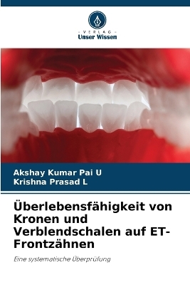 Überlebensfähigkeit von Kronen und Verblendschalen auf ET-Frontzähnen - Akshay Kumar Pai U, Krishna Prasad L