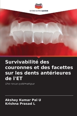 Survivabilité des couronnes et des facettes sur les dents antérieures de l'ET - Akshay Kumar Pai U, Krishna Prasad L