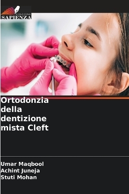 Ortodonzia della dentizione mista Cleft - Umar Maqbool, ACHINT JUNEJA, Stuti Mohan