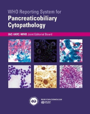 WHO reporting system for Pancreaticobiliary Cytopathology -  World Health Organization,  International Agency for Research on Cancer