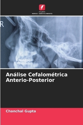 Análise Cefalométrica Anterio-Posterior - Chanchal Gupta