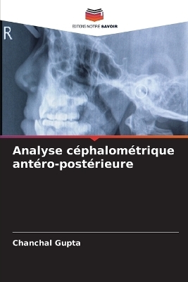 Analyse céphalométrique antéro-postérieure - Chanchal Gupta