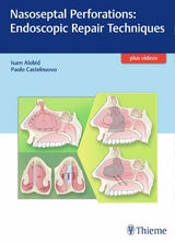 Nasoseptal Perforations: Endoscopic Repair Techniques - 