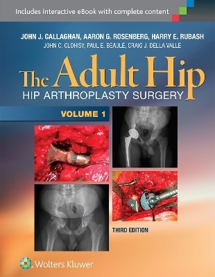 The Adult Hip (Two Volume Set) - 