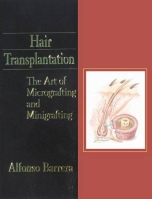 Hair Transplantation - 