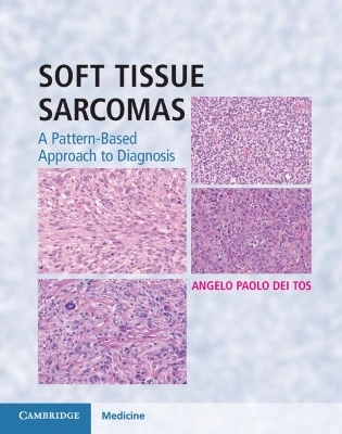 Soft Tissue Sarcomas Hardback with Online Resource - Angelo Paolo Dei Tos